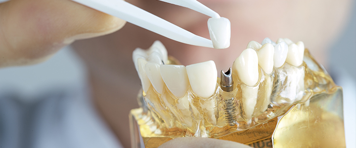 Especialidades odontológicas mais promissoras no mercado | Dental Office