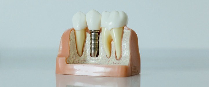 Tudo sobre odontogeriatria: cuidados com a saúde bucal do idoso | Dental Office