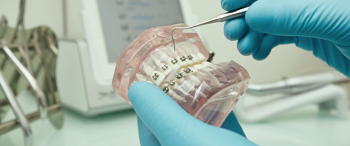 Ortodontia: tudo o que você precisa saber sobre | Dental Office