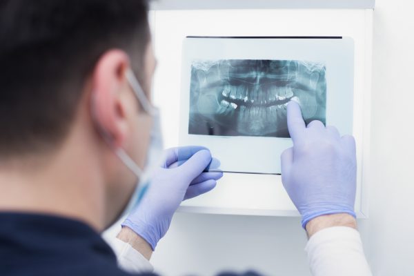 Odontograma Digital: transforme a gestão da sua clínica com o Dental Office