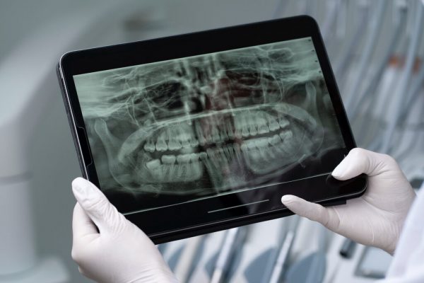 Saiba como acompanhar a inovação na odontologia e transformar sua clínica